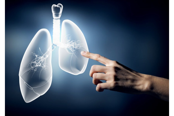 Inteligenta Artificiala Folosita Pentru Diagnosticarea Cancerului Pulmonar