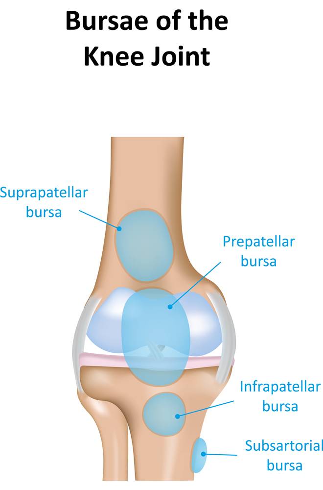cum să amelioreze umflarea cu bursita articulației genunchiului