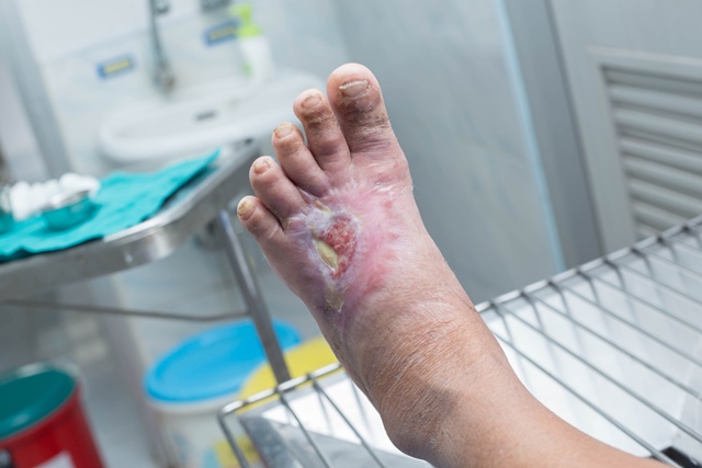 artrita cremei sau unguentului articulației genunchiului