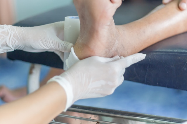 artrita se bate pe degetele de la picioare