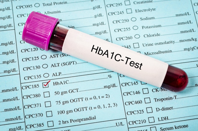 Dureri articulare cu hemoglobină scăzută, Hemoglobina: Ce este? Tipuri si Forme & Cauze