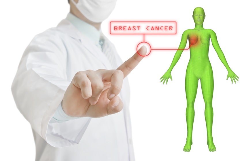 cancer mamar invaziv nst