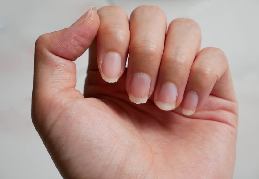 Boli ale articulației unghiilor