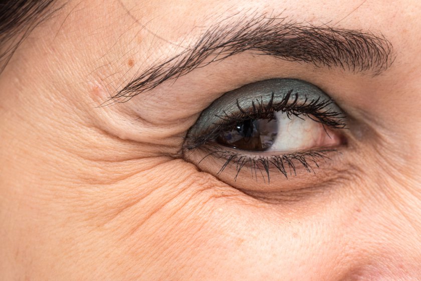 cum să reducă ridurile din jurul ochilor