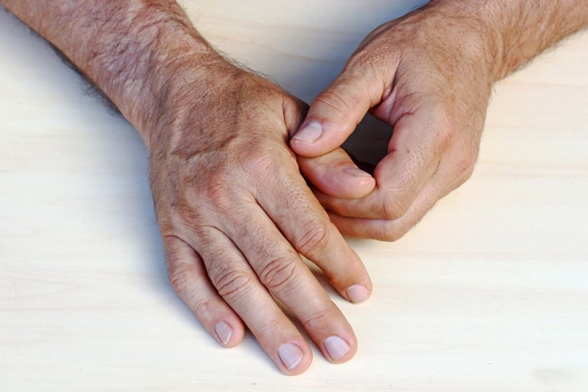 inflamația articulațiilor degetelor