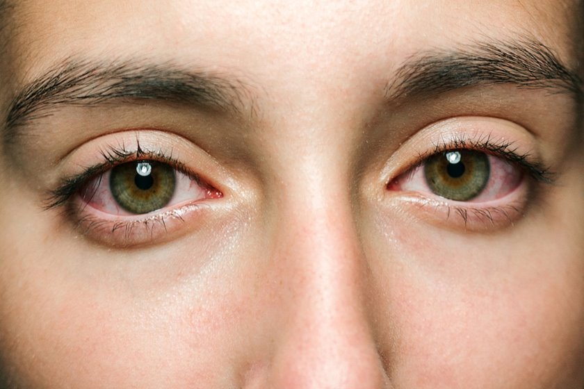 Afectiunile ochiului: cauze, simptome si tratament | Medlife