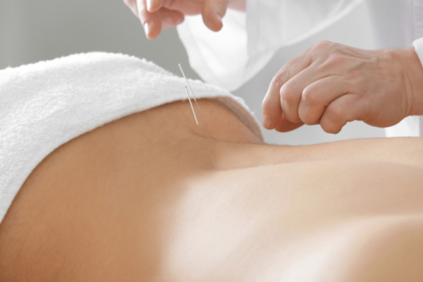 Cum ajută acupunctura la durerea articulară Acupunctură