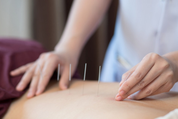 Acupunctura în tratamentul artrozei articulare