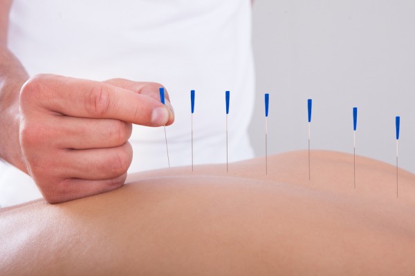 tratamentul cu acupunctura al prostatitei