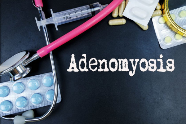 tratamentul adenomiozei în varicoza)