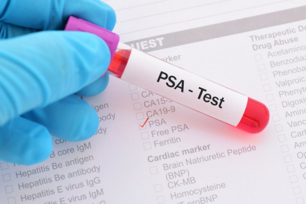 analiza pentru cancer de prostata tinctură de rododendron pentru prostatită