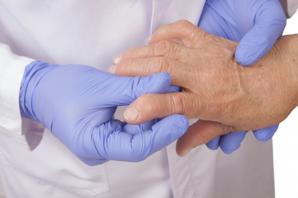 artrita prognosticului mâinilor