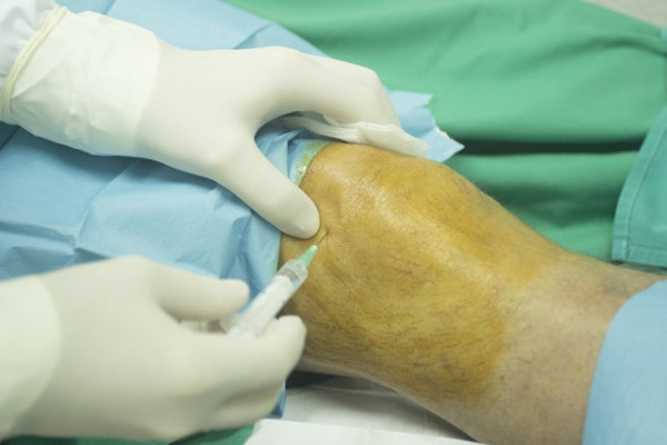 refacerea puncției articulațiilor genunchiului