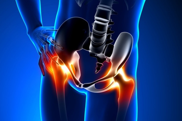 artroza a 4 a etapă a articulației șoldului ce dureri articulare afectează
