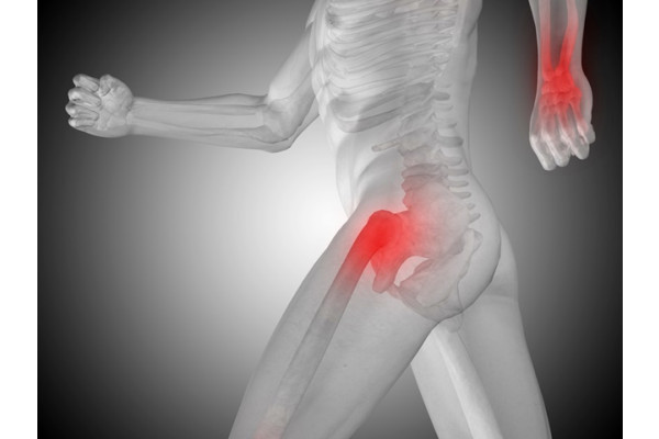 dureri ale articulației șoldului și genunchiului)