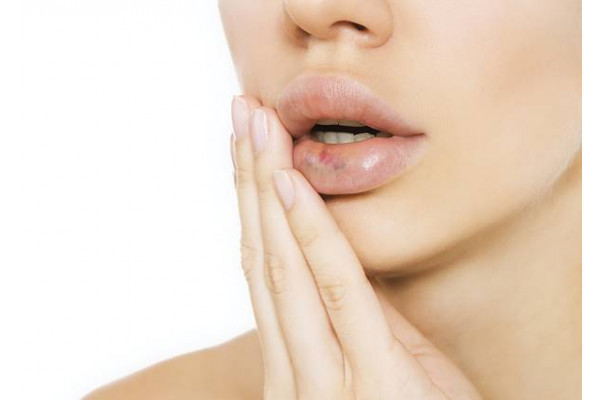 amorteala mainilor si buzelor probleme reumatologice