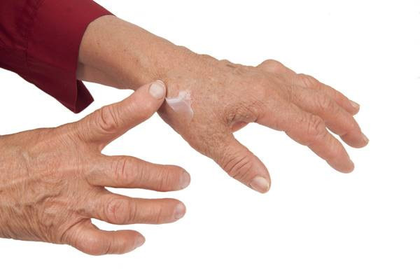inflamația articulației preparatelor degetelor mari