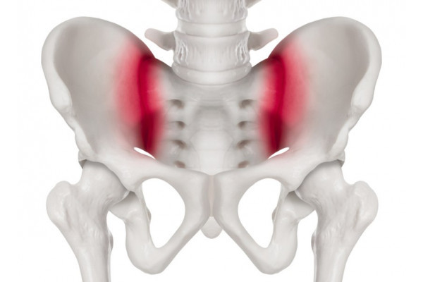 dureri cronice la nivelul articulației sacroiliace tratamentul osteoartrozei genunchiului tratament de 2 grade