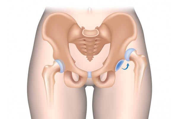 articulații și articole de ligamente eficacitatea condroprotectoarelor pentru artroza genunchiului