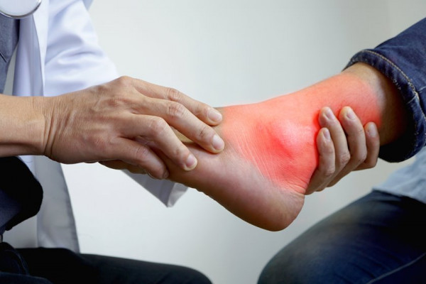 glezna întorsă cum să tratezi cum să tratezi durerea în articulațiile picioarelor piciorului