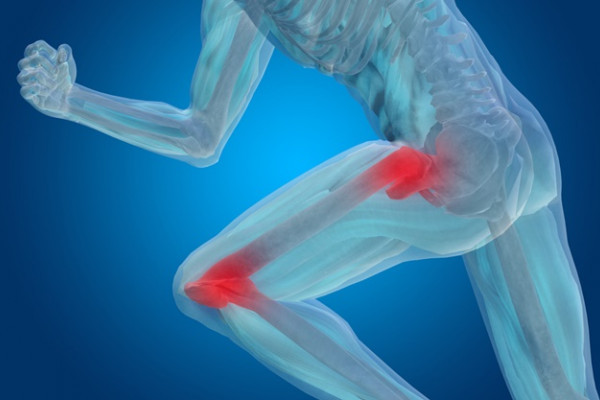 tratamentul coxartrozei articulației umărului boala de luxatie a genunchiului