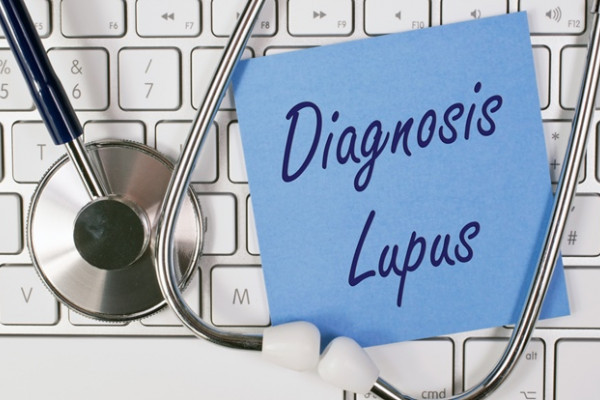 Awkward boundary Acrobatics Lupus eritematos cutanat: cauze, simptome si tratament