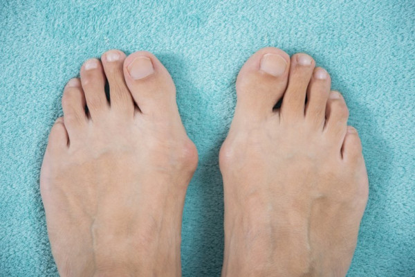 inflamația articulației degetelor de la picioare