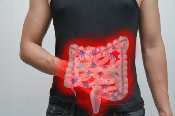 Paraziti intestinali simptome