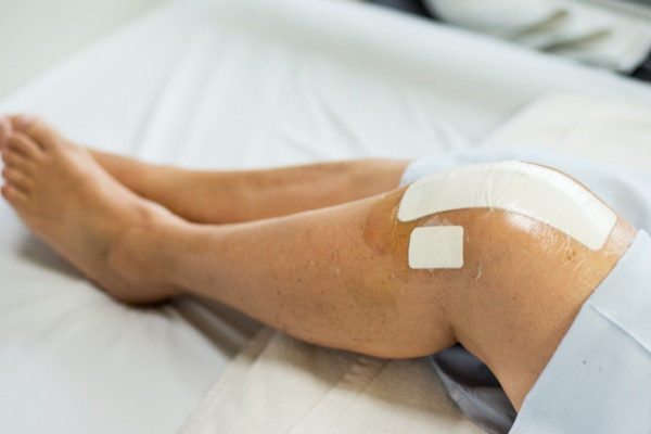 afectarea ligamentului cruciat al genunchiului