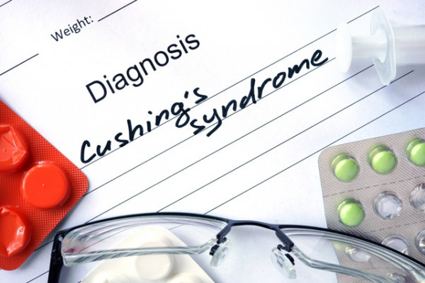 Sindromul Cushing: cauze, simptome si complicatii Cushing pierderea în greutate