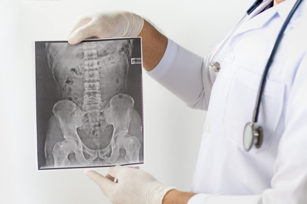 radiografie articulatii sacroiliace pret