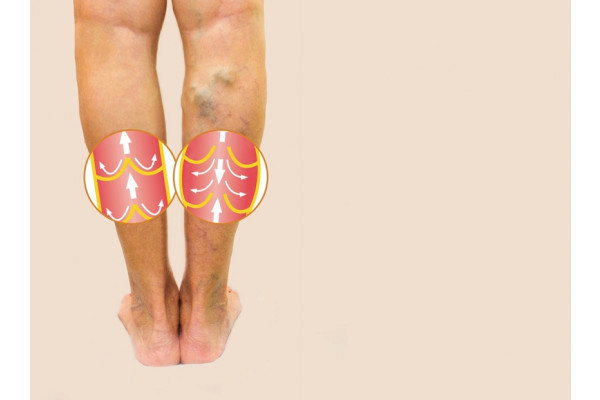 cum se vindeca genunchii în vopsire