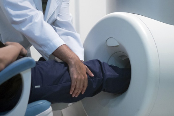 artrita reumatoidă a genunchiului radiomarcat