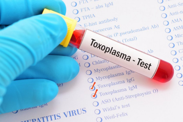 Toxoplasma simptome