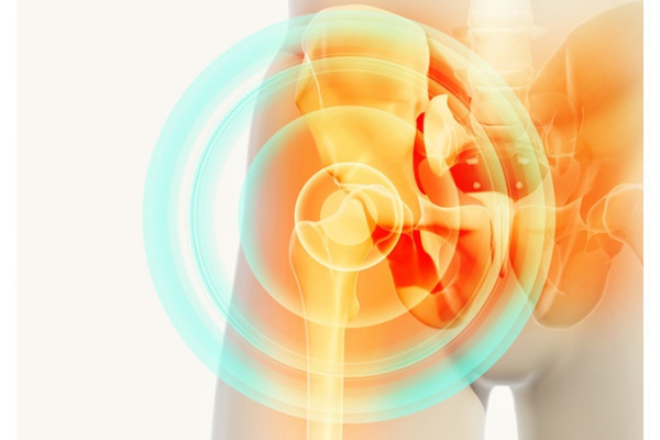 inflamația bursitei sacului articular regim de tratament cu coxartroză