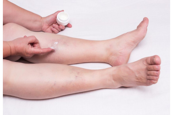 injecia pentru tratamentul cu varicoza magneziu cu picior varicos