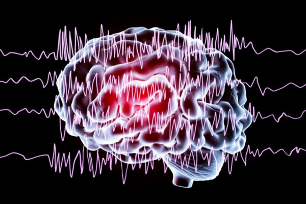 Epilepsia: Cauze, Simptome, Tratament