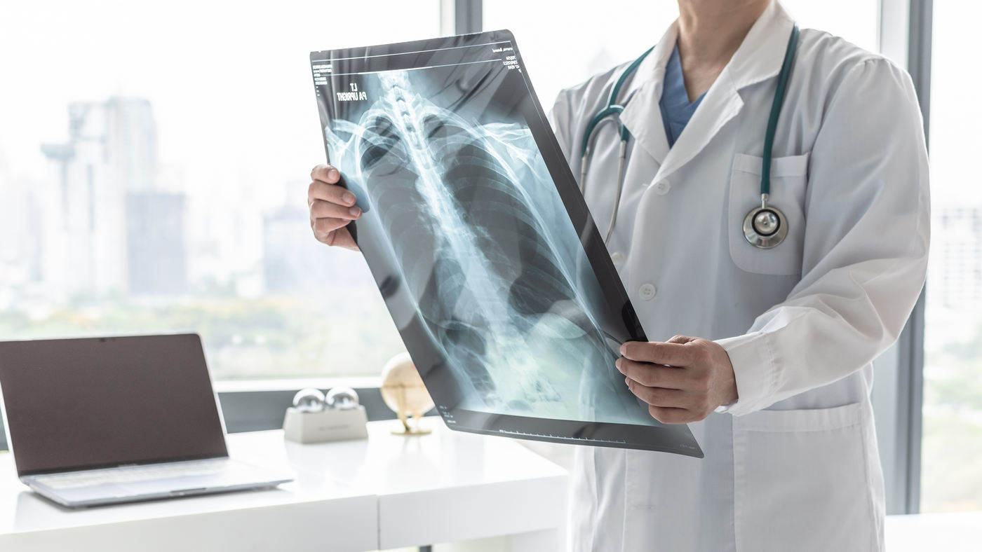 Sindromul De Detresă Respiratorie Acută Sdra Cauze Simptome Tratament
