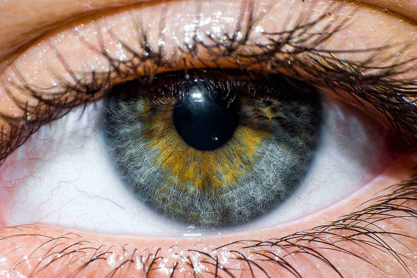 transplantul de cornee restabilește vederea viziune bună cum să restabiliți