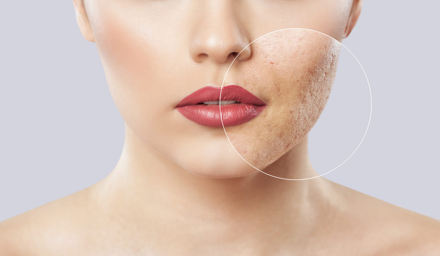 Cum se îngrijeşte pielea pe sub masca de protecţie şi ce tip de machiaj trebuie folosit