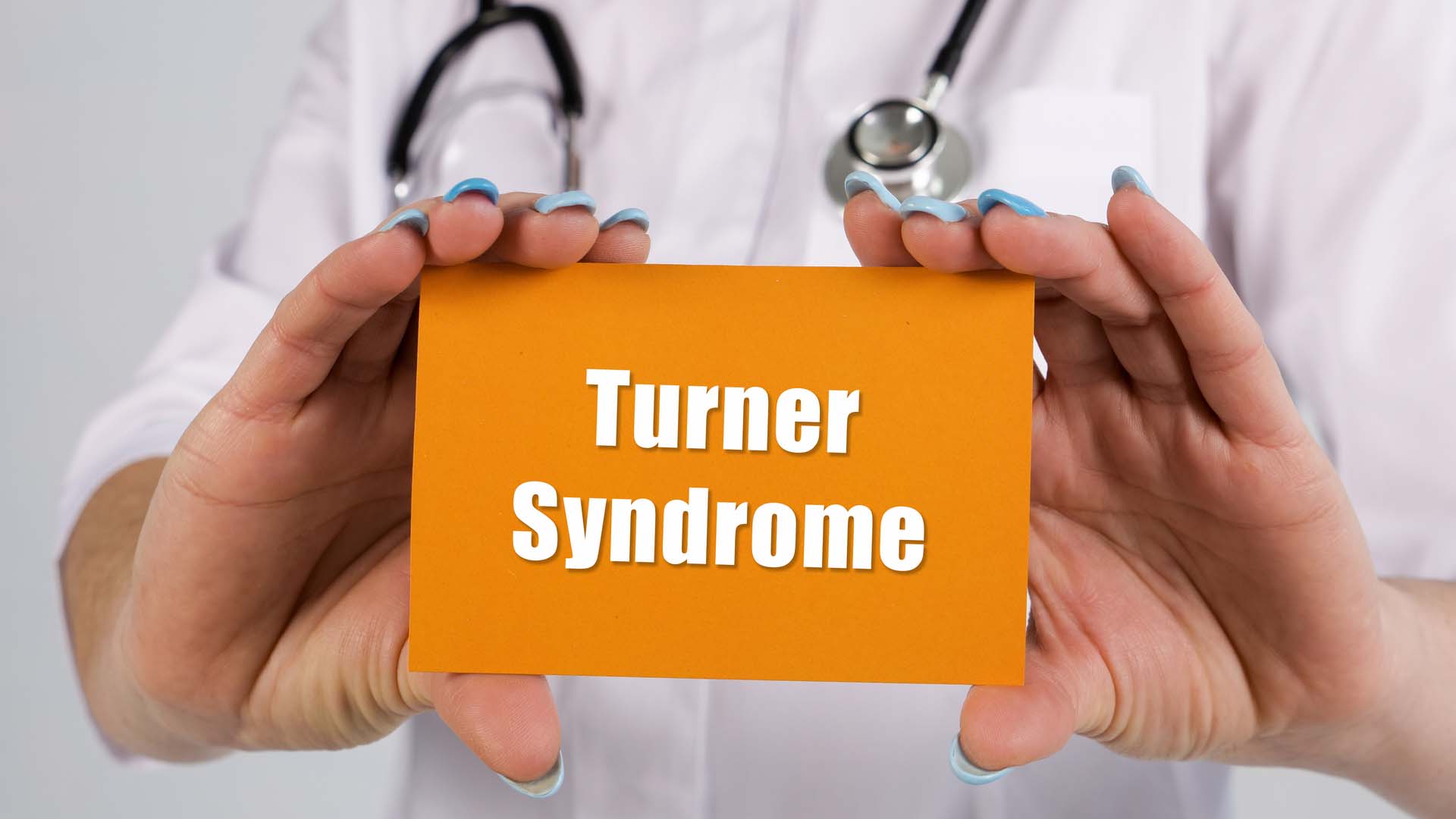 Sindromul Turner: cauze, simptome, tratament