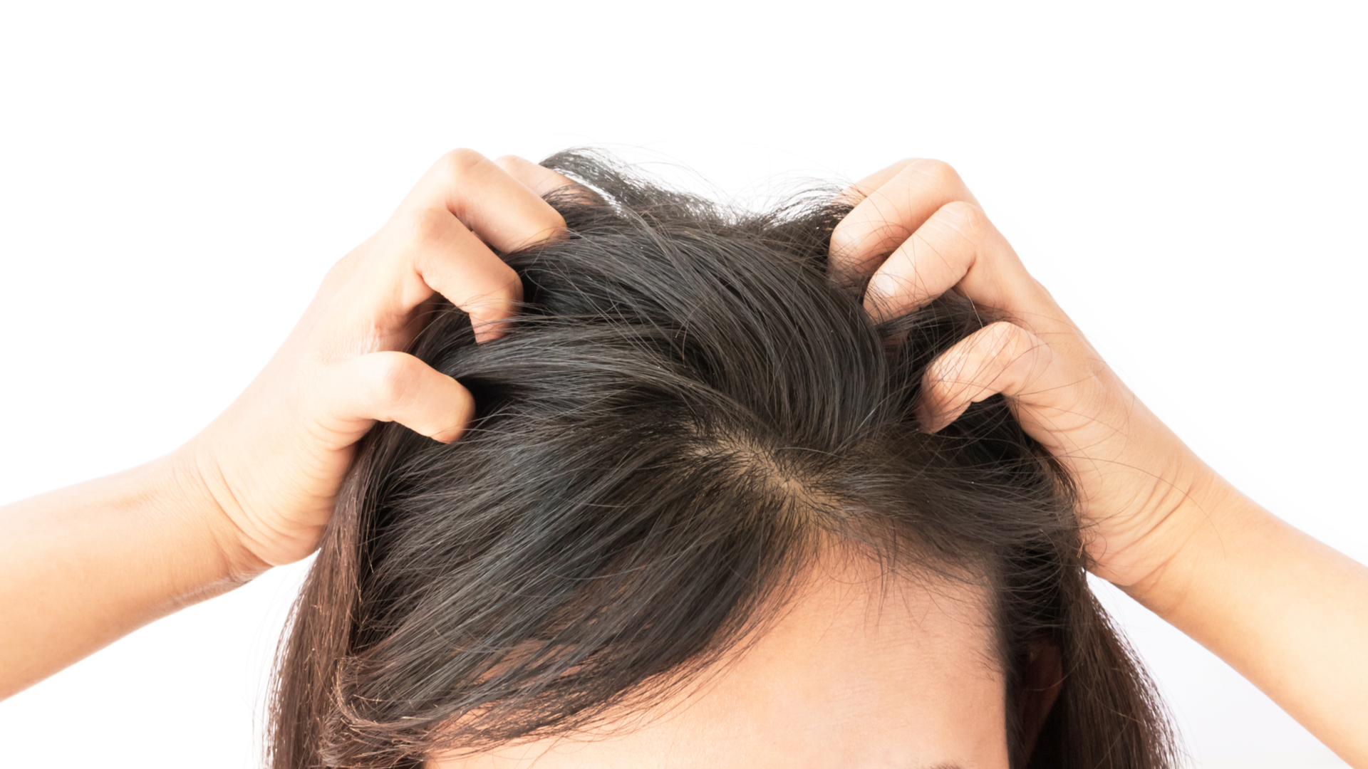 Senzatia de mancarime la nivelul scalpului - cauze si remedii