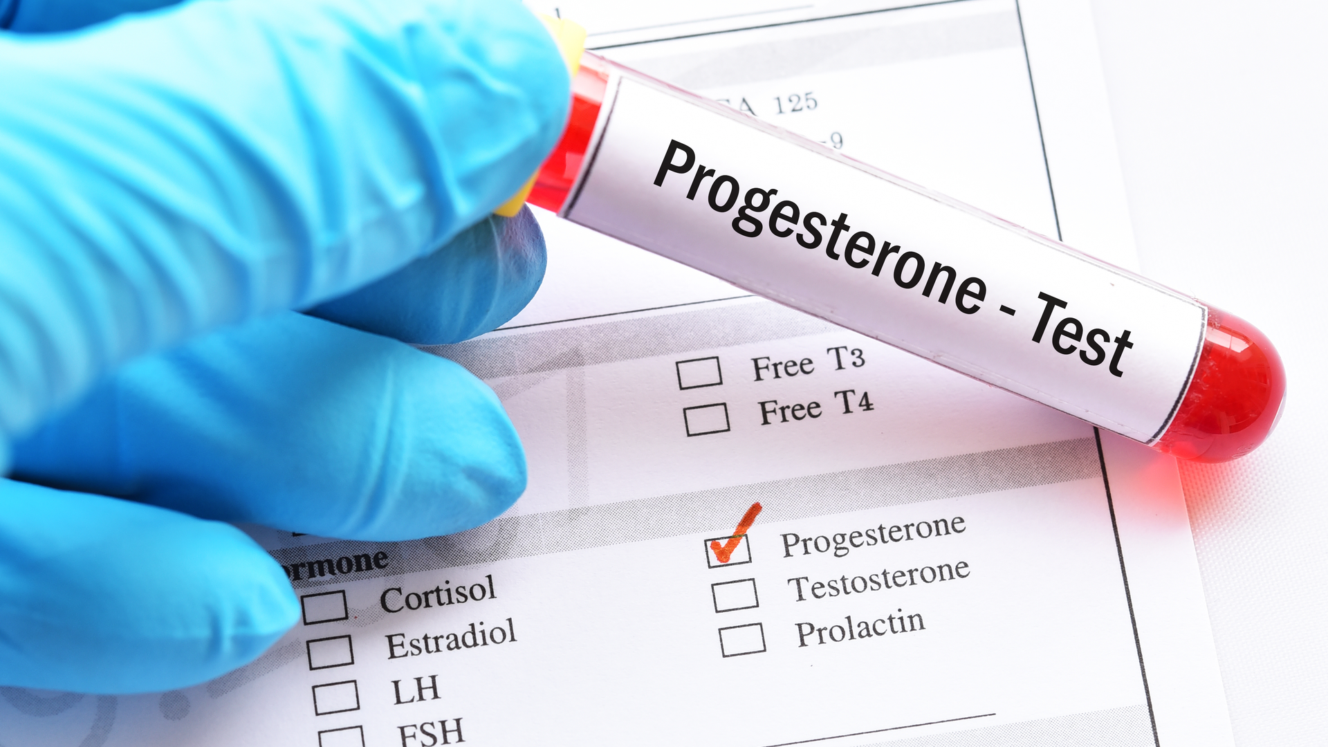 Totul despre progesteron: rol, valori, complicatii