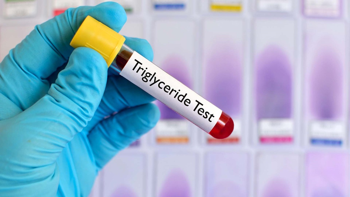 Trigliceridele mărite: care sunt cele mai frecvente cauze?