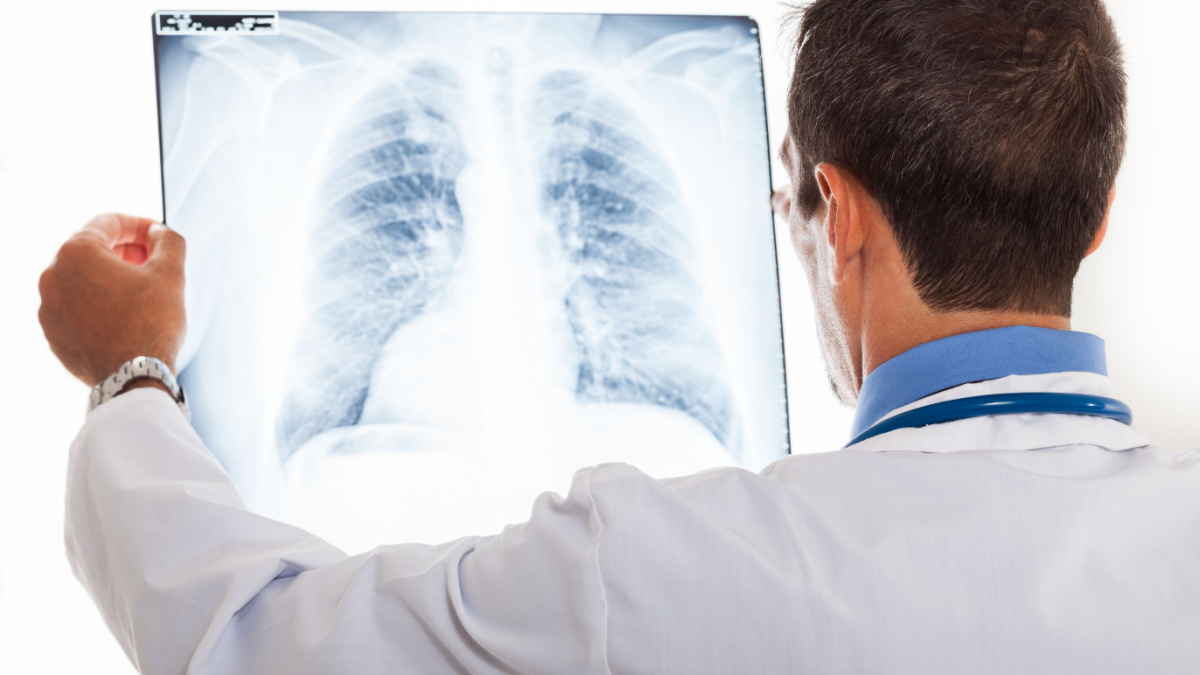 Micronoduli pulmonari: simptome, cauze, tratament
