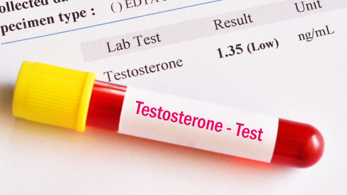 Un nivel mare de testosteron afecteaza sanatatea femeilor [studiu]