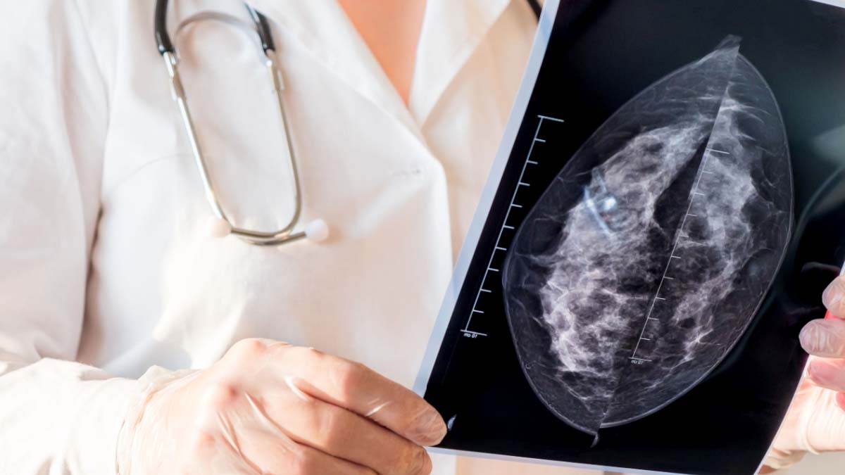 Multe femei nu-si mai fac mamografii dupa rezultate fals-pozitive
