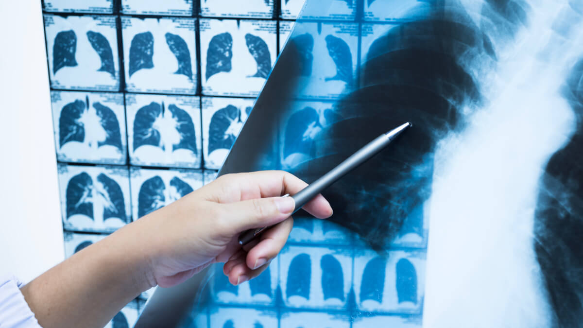 Tomografia computerizata si tomografia cu emisie de pozitroni