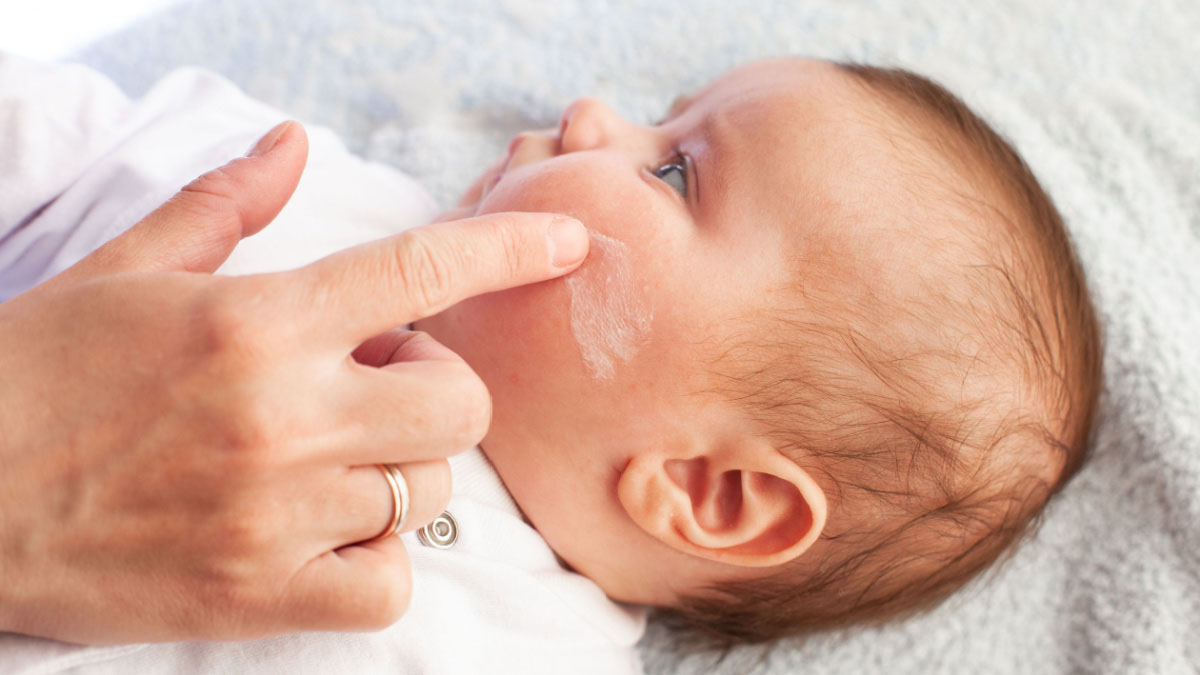 Alimentatia mamei in perioada de alaptare si dermatita atopica la bebelusi