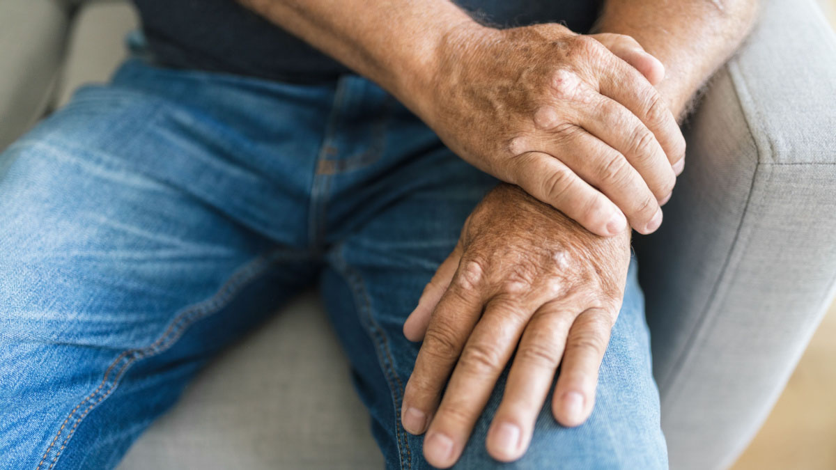 Cum afecteaza artrita psoriazica viata sociala si profesionala?